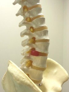 Back Injury